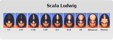 Hair Loss Scale
