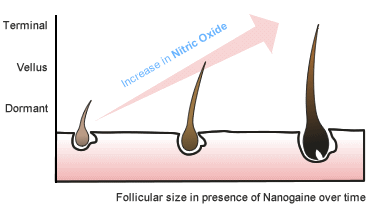 Nanogaine treats hair loss