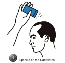 Thinning Hair