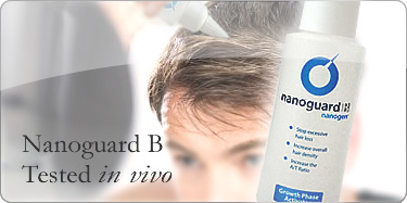 Hair Loss Treatment